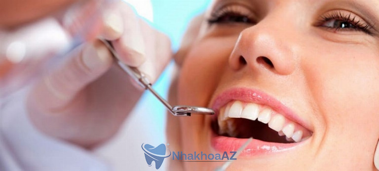 Chọn địa chỉ uy tín để dán Venner