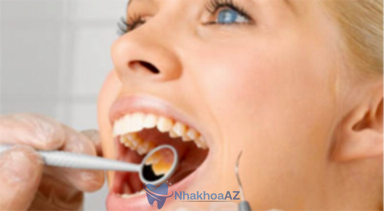 Nên kiểm tra nguyên nhân nổi mụn trắng ở nướu răng là gì để có phướng án điều trị tốt nhất