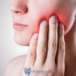 Răng ê buốt sau khi bọc sứ