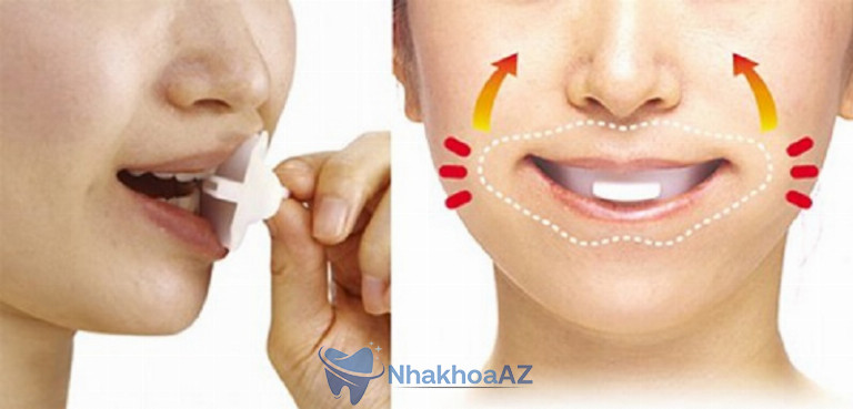 Sử dụng hàm bảo vệ cho trường hợp nghiến răng