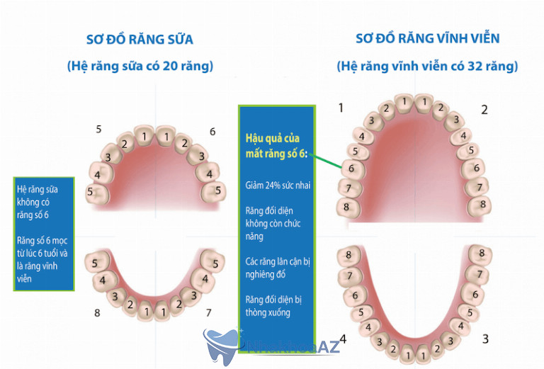 Bộ răng của người trưởng thành có 32 chiếc, trong đó răng hàm nằm vị trí trong cùng của hàm