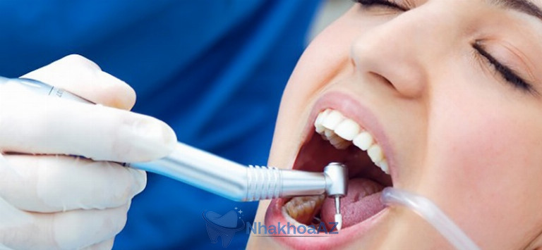 Cần có thói quen thăm khám nha khoa định kỳ