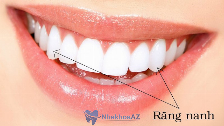 Hình ảnh răng nanh trên cung hàm