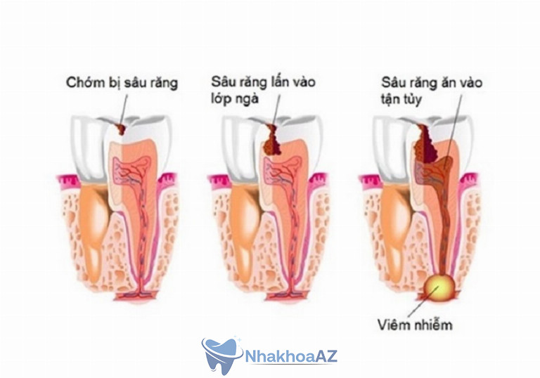 Tùy vào tình trạng viêm tủy, bác sĩ sẽ đưa ra phương pháp chữa trị tối ưu nhất
