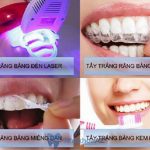 tác hại của tẩy trắng răng