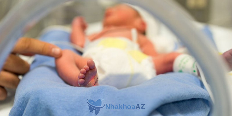 Trẻ sinh non là lý do phổ biến khi trẻ bị chậm mọc răng